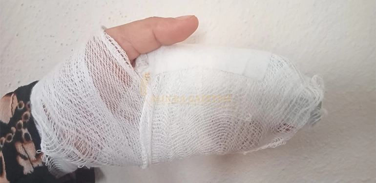 alucrada sokak kopekleri kadina saldirdi 1 yarali 2 Alucra, Alucra Gazetesi, Alucra Haberleri